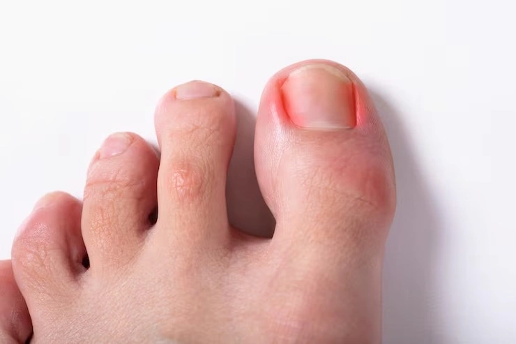 Podologia para pés diabéticos