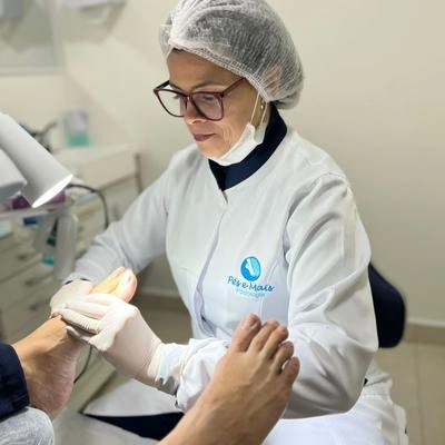 Tratamento para unha encravada em Osasco